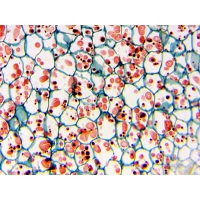 Mikroskop DeltaOptical BioLight 300 40x-400x + Kamera DLT-Cam Basic 2 MP
